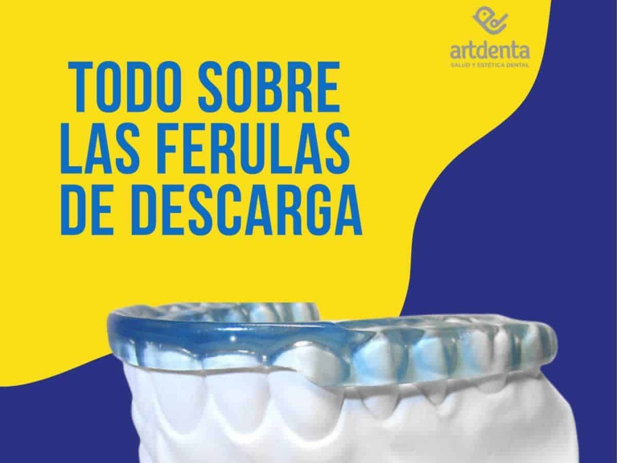 ACWOO Ferula Descarga Bruxismo, 4Pcs Férulas Dentales, Férula